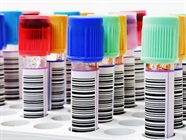 Optimizing Cytokine Detection in Clinical Research
