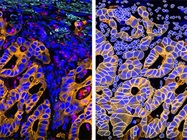 Advancing Spatial Biology with Fluorescence-Based Multiplexed Imaging