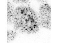 MedChemExpress Reagent for Triggering Lysosomal Stress and Damage