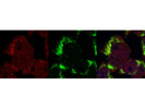 Unlocking Lysosomal Insights: Galectin-3 Monoclonal Antibody from Invitrogen