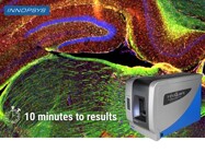 Accelerate and automate your imaging workflow for neurosciences studies