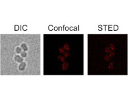 A Super-Resolution Approach for High-Resolution Imaging of Bacterial Cell Wall Remodeling