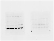Guide to Total Protein Normalization in Western Blotting