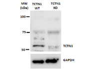 Proteintech TCTN1 Antibody Works Well for Western Blot Detection of TCTN1 Knockout