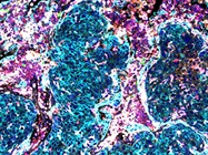 Traditional vs. Multiplex Immunohistochemistry