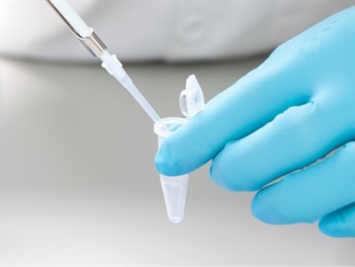 Western Blot Sample Prep