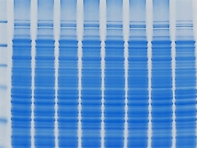 Electrophoresis and Electrotransfer
