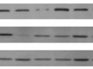 How to Improve Western Blot Data Accuracy with Total Protein Normalization