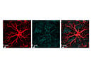 Illuminate Mitochondria with VDAC1 from Abcam