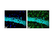 Power Up Your SOD1 Detection with Invitrogen’s Trusted Antibody