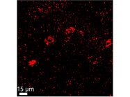 Clear and Sensitive Detection of Oprm1 (µ-Opioid Receptor) mRNA in Mouse Brain with RNAscope™ from Bio-Techne