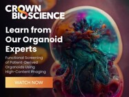 Webinar: Functional Screening of Patient-Derived Organoids Using High-Content Imaging