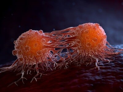 A computer render of two migrating cancer cells.