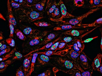 A fluorescence microscopy image of a tumor cross section.
