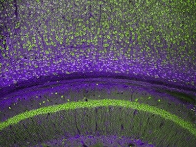 A fluorescent cross section of a murine brain.
