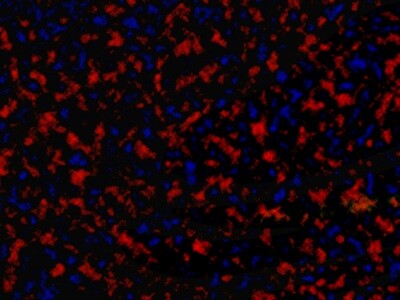 An abstract image representing fluorescent-stained cells imaged under a microscope.
