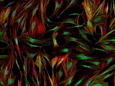 Fluorescence microscopy image of stained human cells
