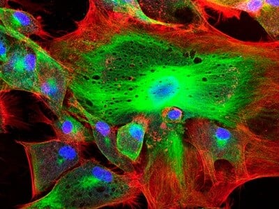 A confocal microscopy-generated image of stained fibroblast cells.