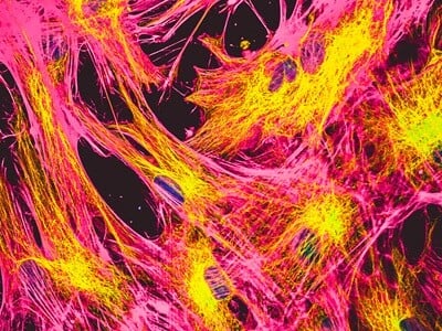 A confocal microscopy-generated image of stained fibroblast cells.