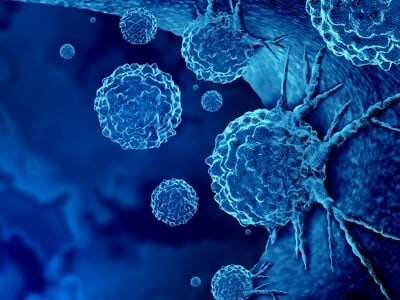 : A computer render of cancer cells adherent to a tissue wall.