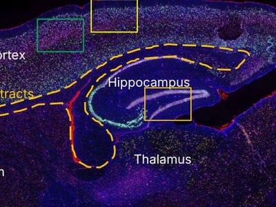 Mapping Neuroinflammation with Spatial Multiomics