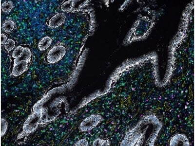 Harmonizing Global Operations with Advanced Spatial Biology
