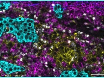 Turn Spatial Biology Ideas into Insights