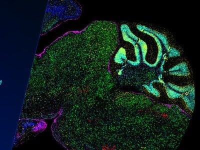 Fully-Automated Spatial Multiomics at Scale