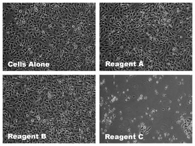 Cellular Toxicity Caused by Transfection: Why is it important?