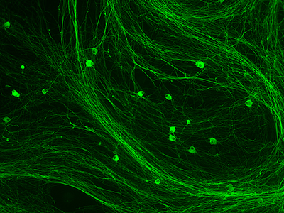 ganglion cells