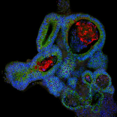 organoid