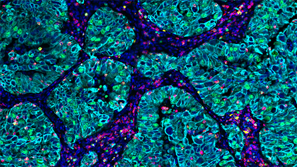 immunophenotyping