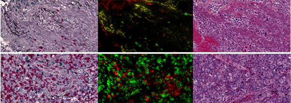 IHC