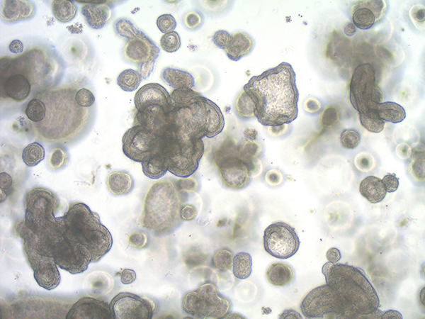 organoids