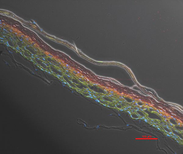 organoids