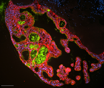 organoids