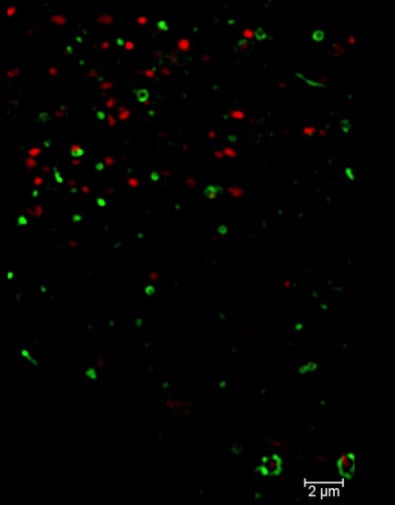 protein trafficking