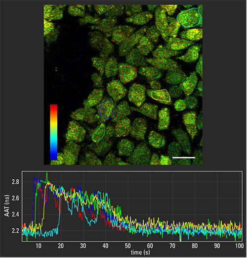 fluorescence microscopy