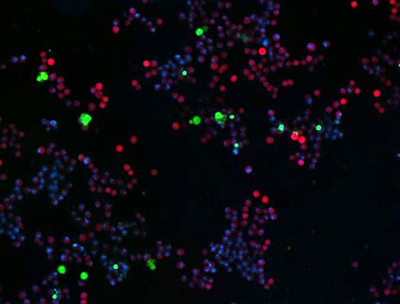 apoptosis