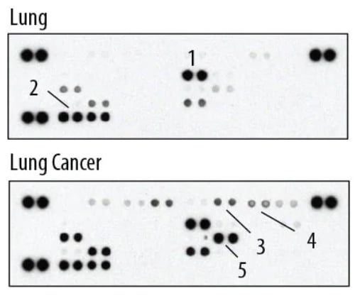 antibody microarray