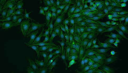 secondary antibodies