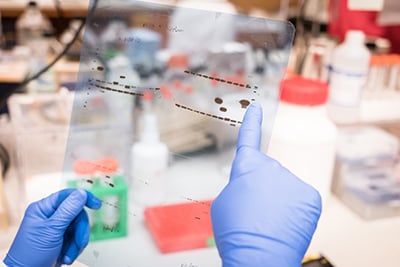 western blot