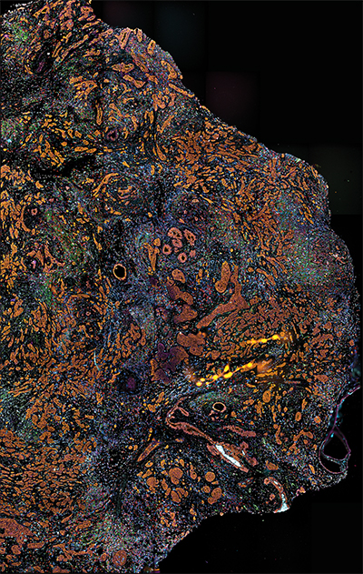 spatial biology