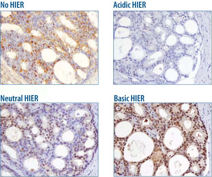 IHC