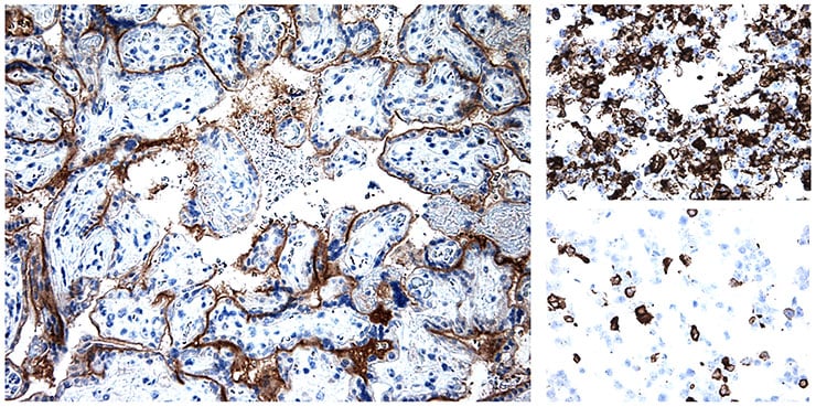 IHC