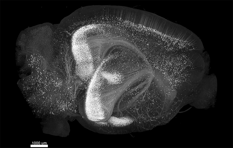lightsheet microscopy