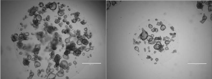organoids