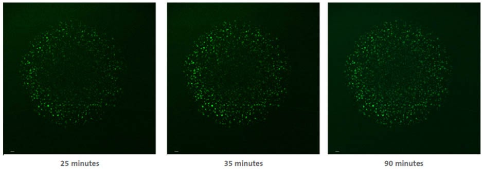 organoids