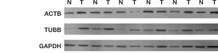 western blotting