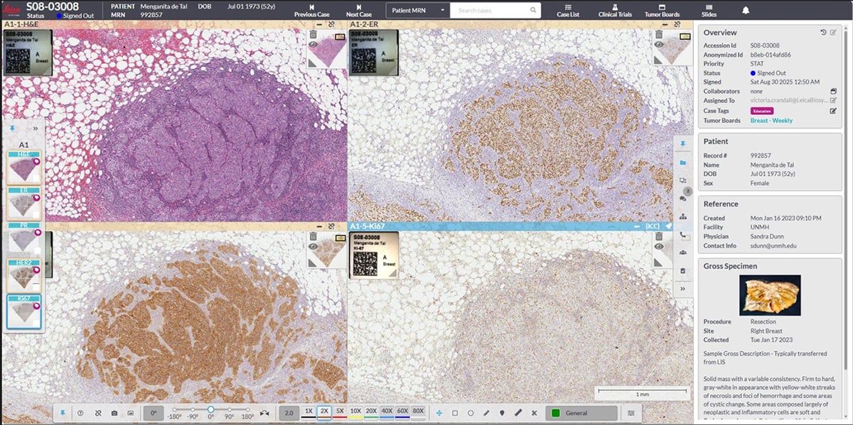 digital pathology